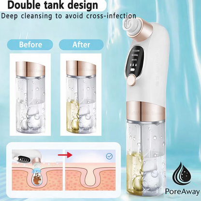 PoreAway Remover Vacuum